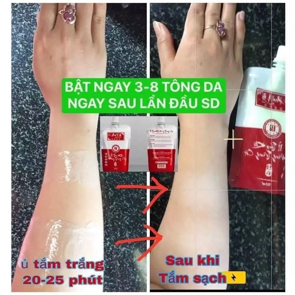 Вьетнамский отбеливающий лосьон - Фотография_5