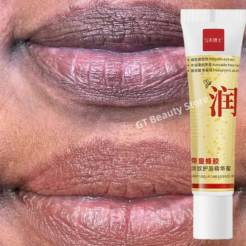 Удаление темных губ бальзам для - Фотография_3