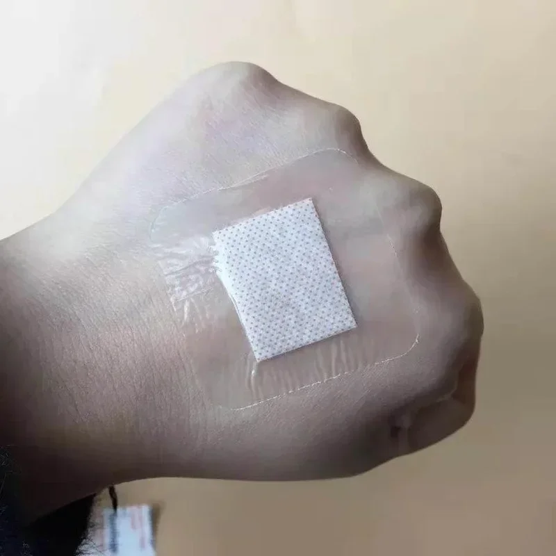 Гипоаллергенная нетканая клейкая повязка на рану - Фотография_5