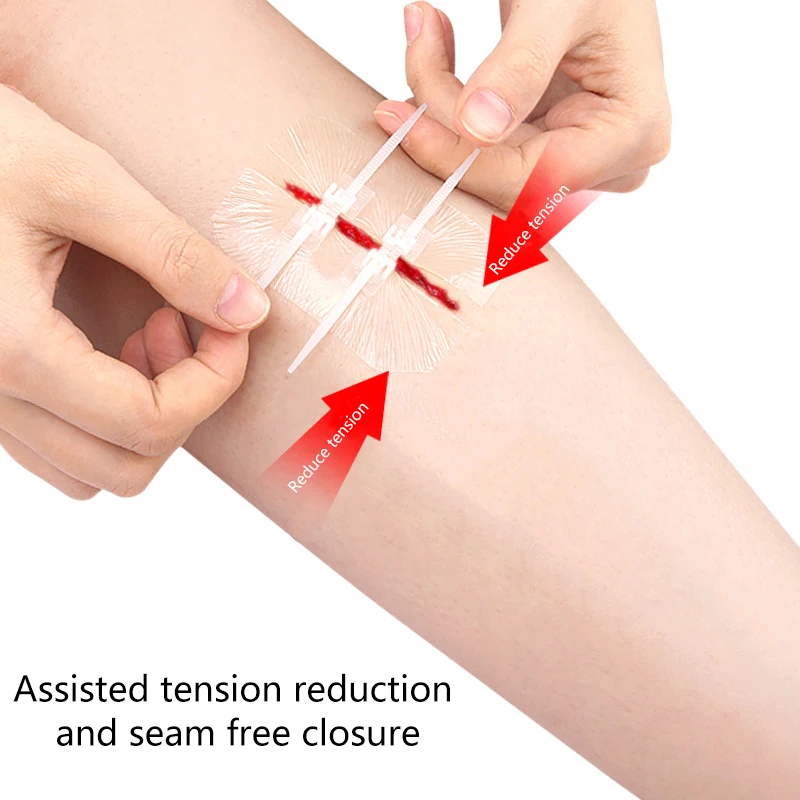 Застежка-молния, застежка-молния, - Фотография_3