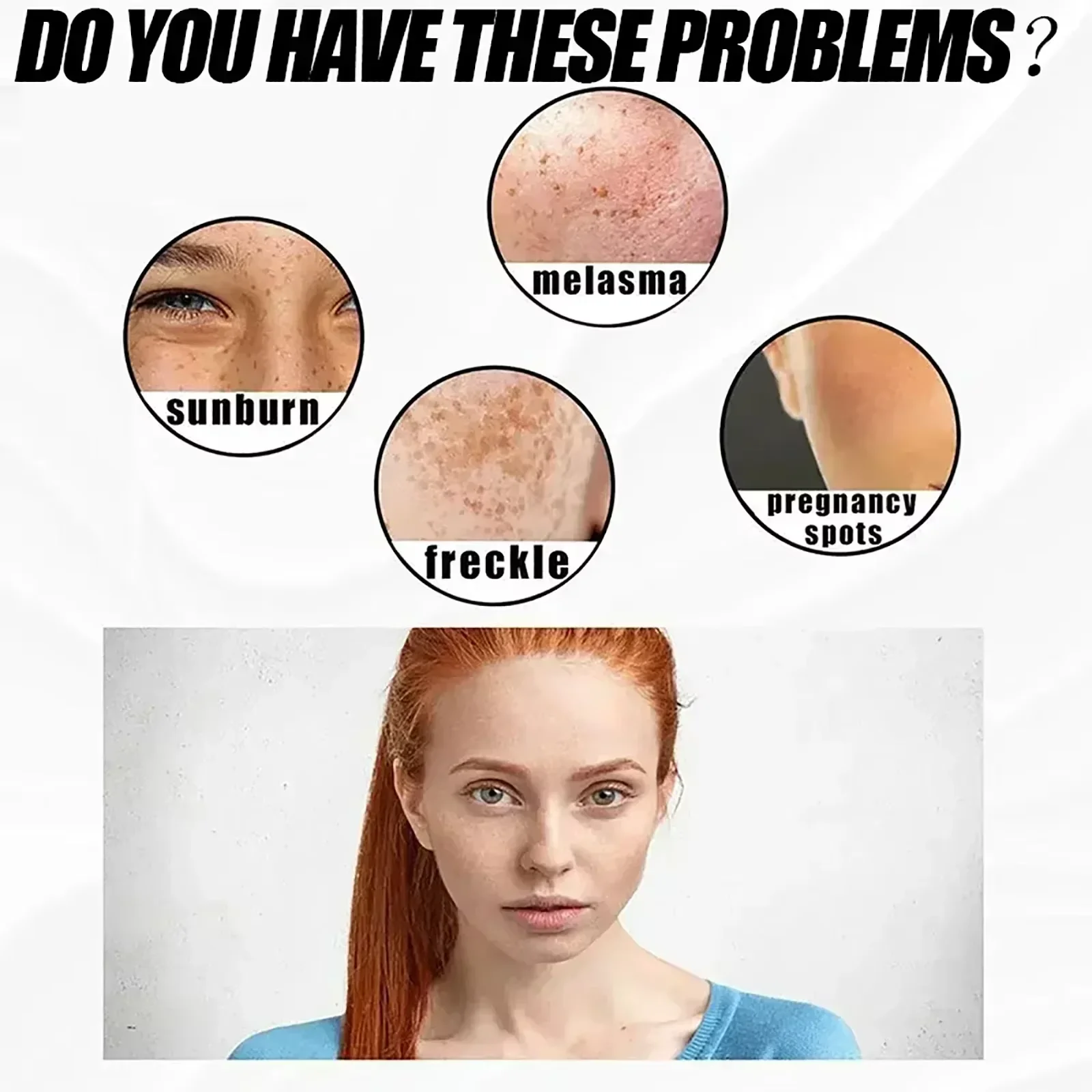 Eelhoe ниацинамид мелазма осветляющий - Фотография_2