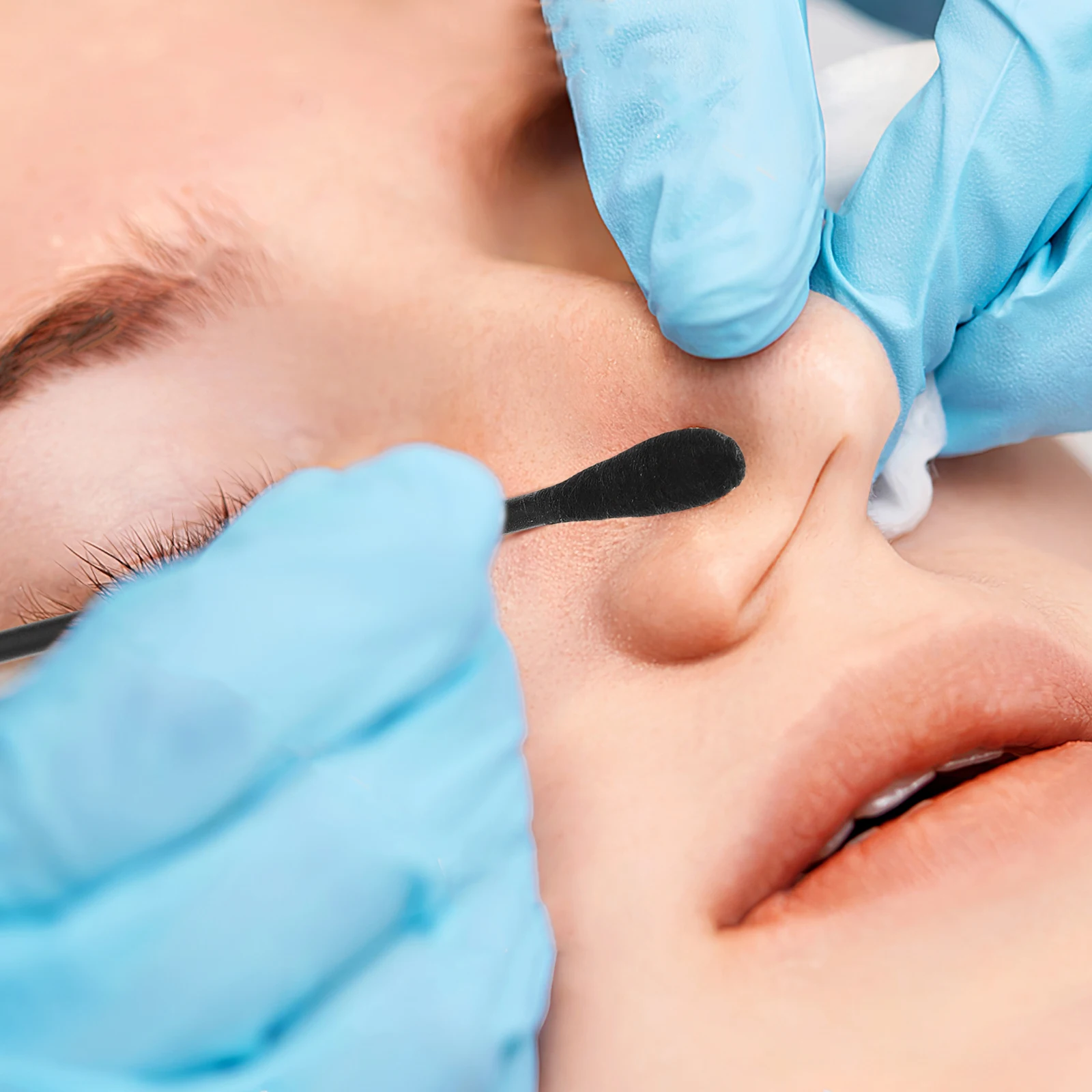 Ватные палочки для угрей