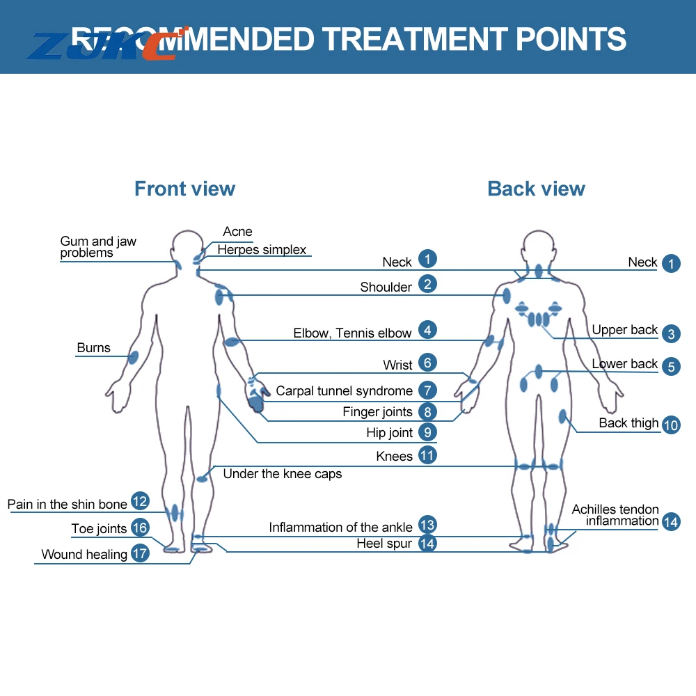 Zjkc лазер для лечения артрита и ран - Фотография_4