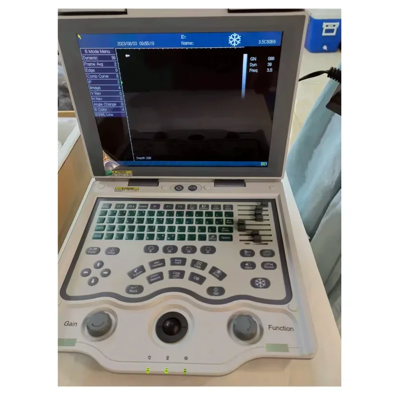 Года портативный ультразвуковой - Фотография_5