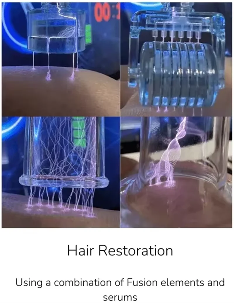 Новейшая технология fusion plasma - Фотография_5