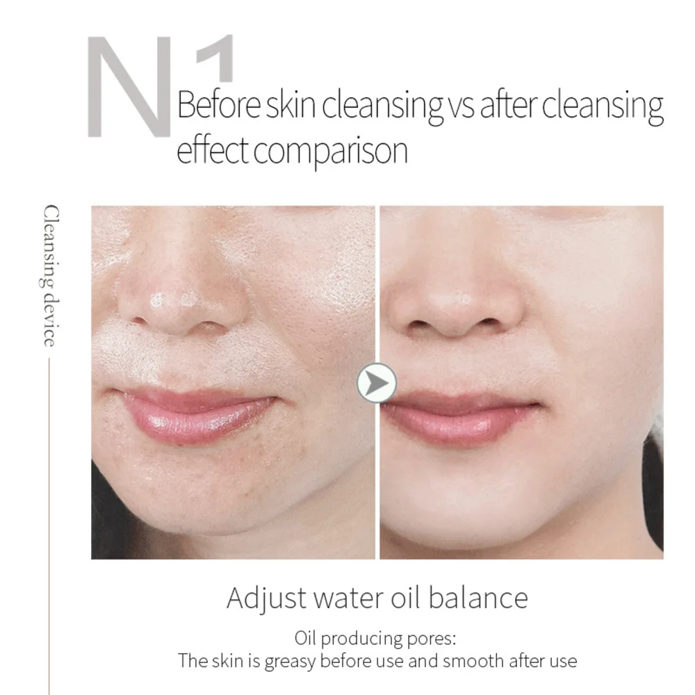 Hydra bubble skin beauty кислород - Фотография_5