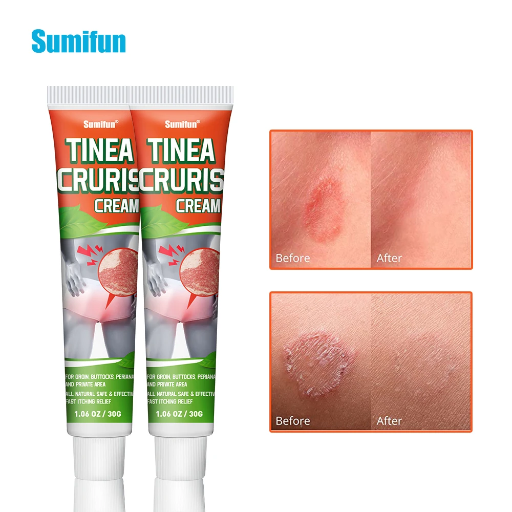 Китайская медицина против зуда sumifun