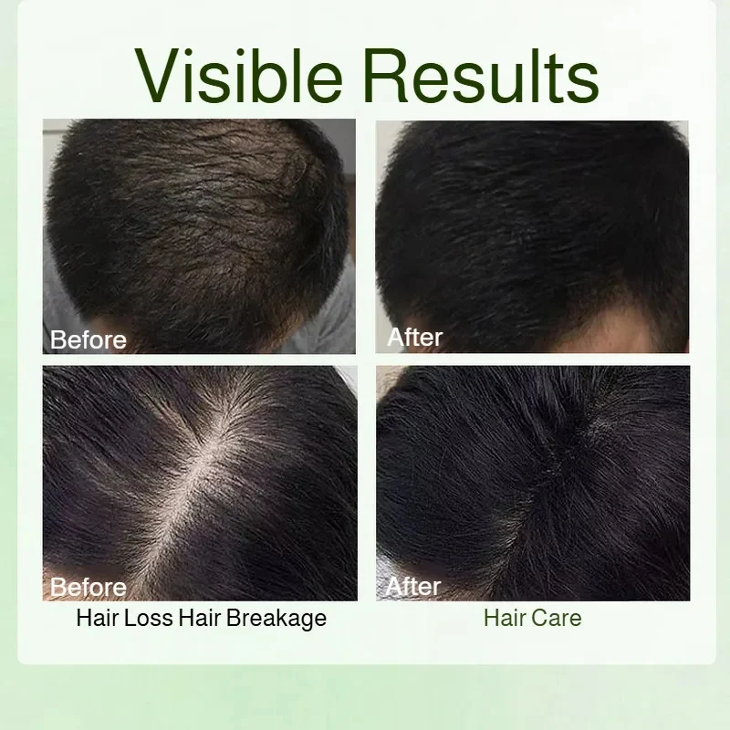 Натуральное травяное мыло-шампунь - Фотография_5