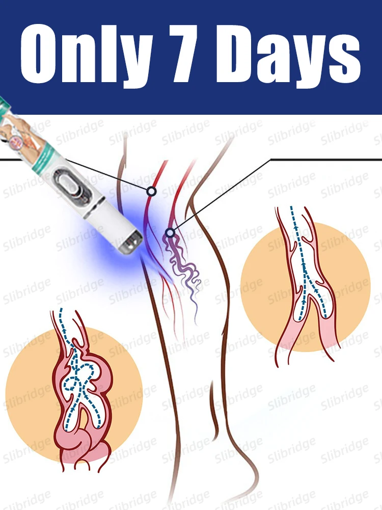 Инструменты для ухода за ногами