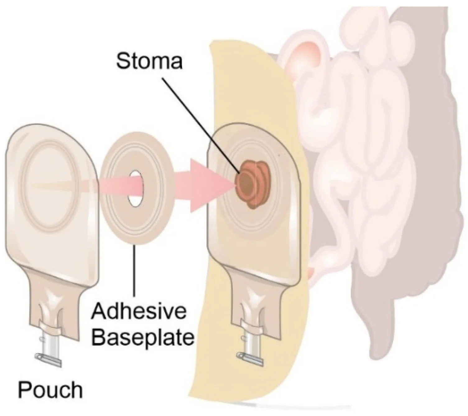 Оптовая продажа, цельный дренажный - Фотография_4