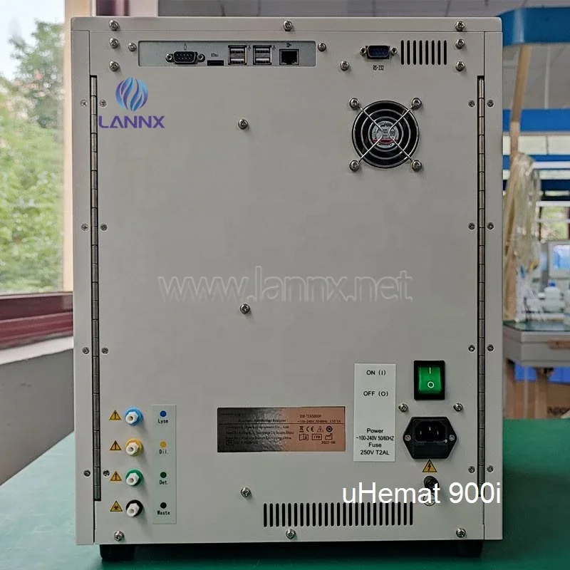Uhemat 900i заводской анализатор - Фотография_4