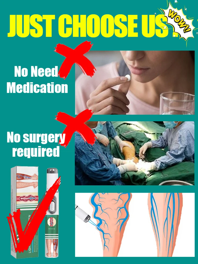 Лазерная ручка для веней удаление - Фотография_4