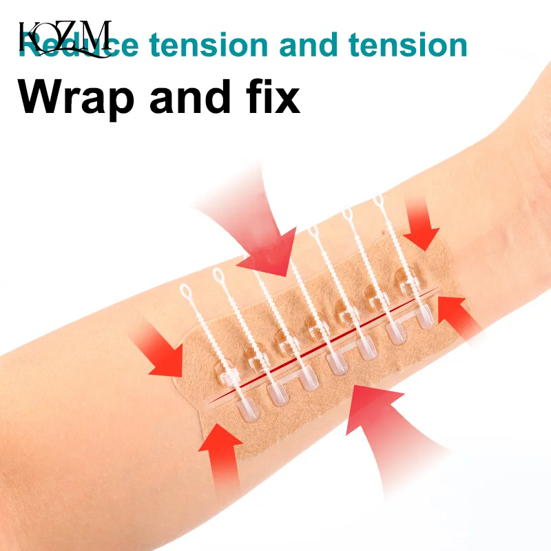 Застежка-молния, пластырь для закрытия - Фотография_3