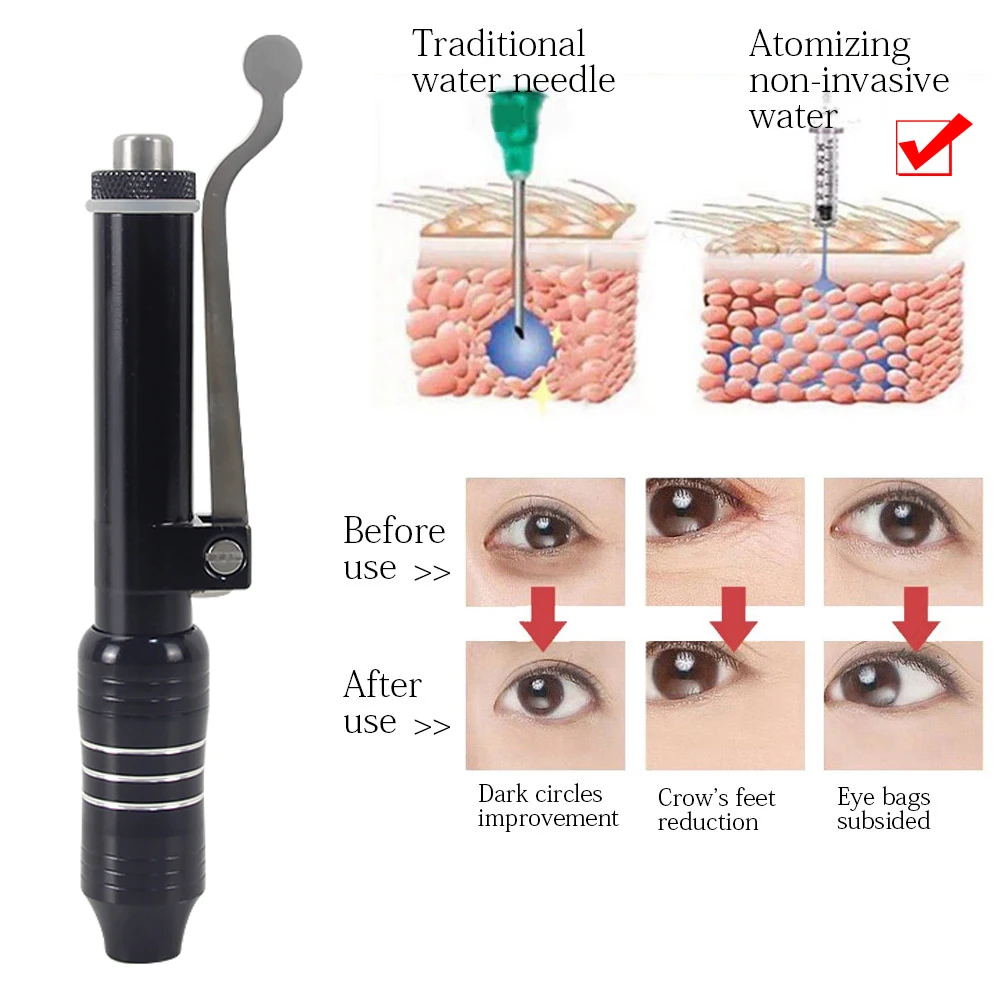 Гиалуроновая ручка высокого давления - Фотография_2