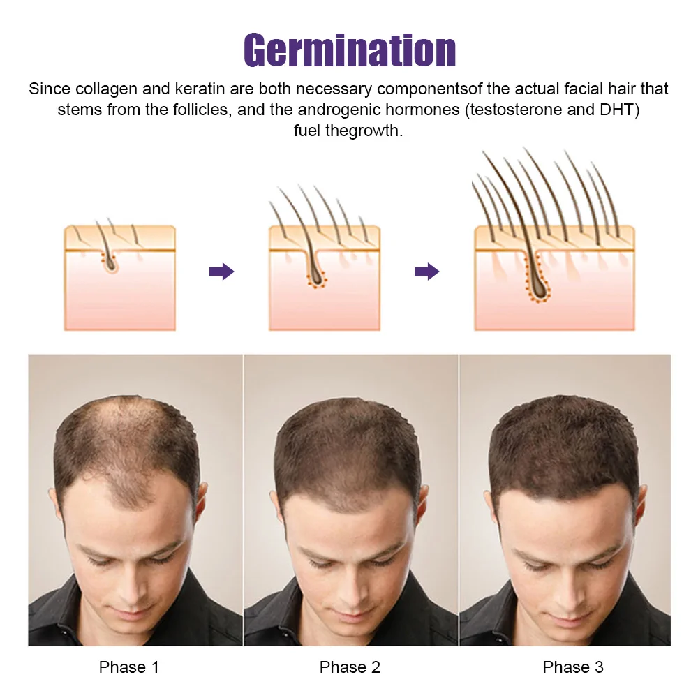 Derma professional microneedling массажный ролик для лица для роста бороды - Фотография_4