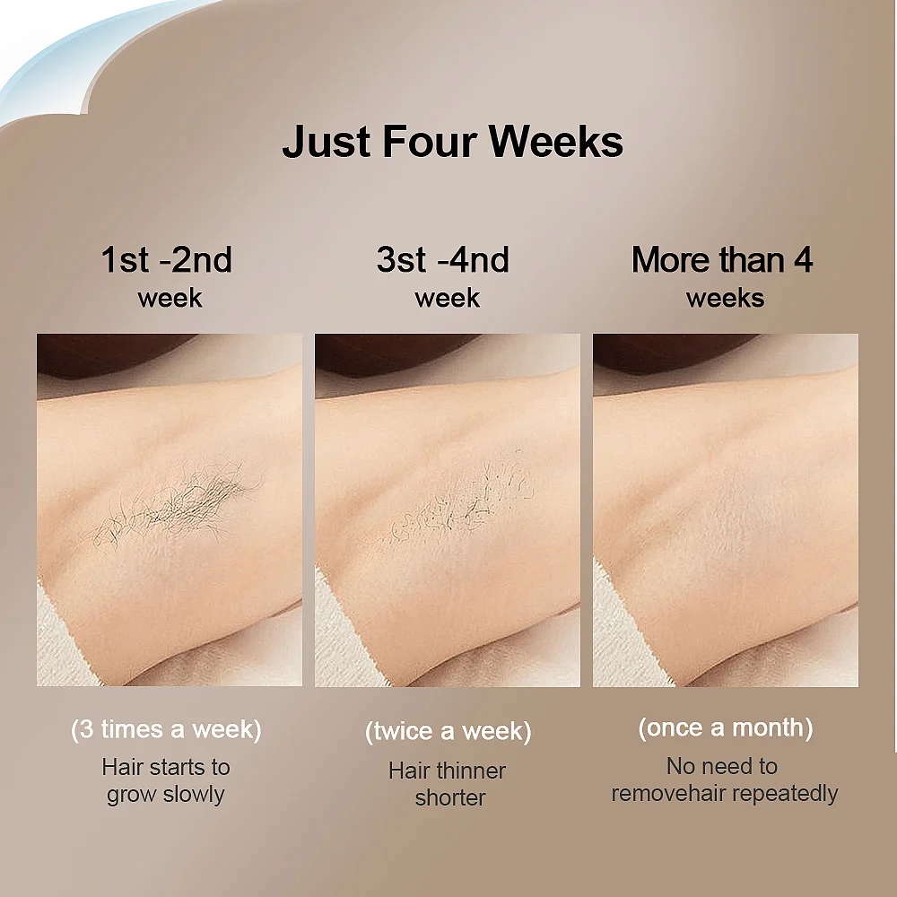Лазерное удаление волос kinseibeauty ipl - Фотография_6