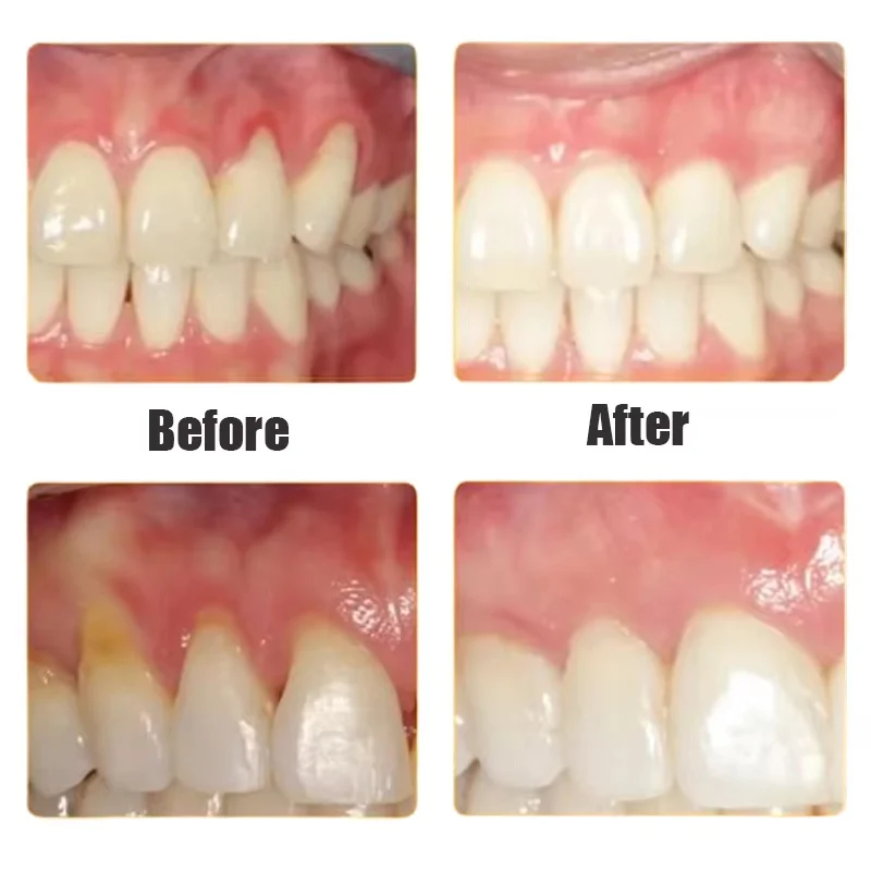 Гелевая сыворотка для ухода за поврежденными деснами - Фотография_2