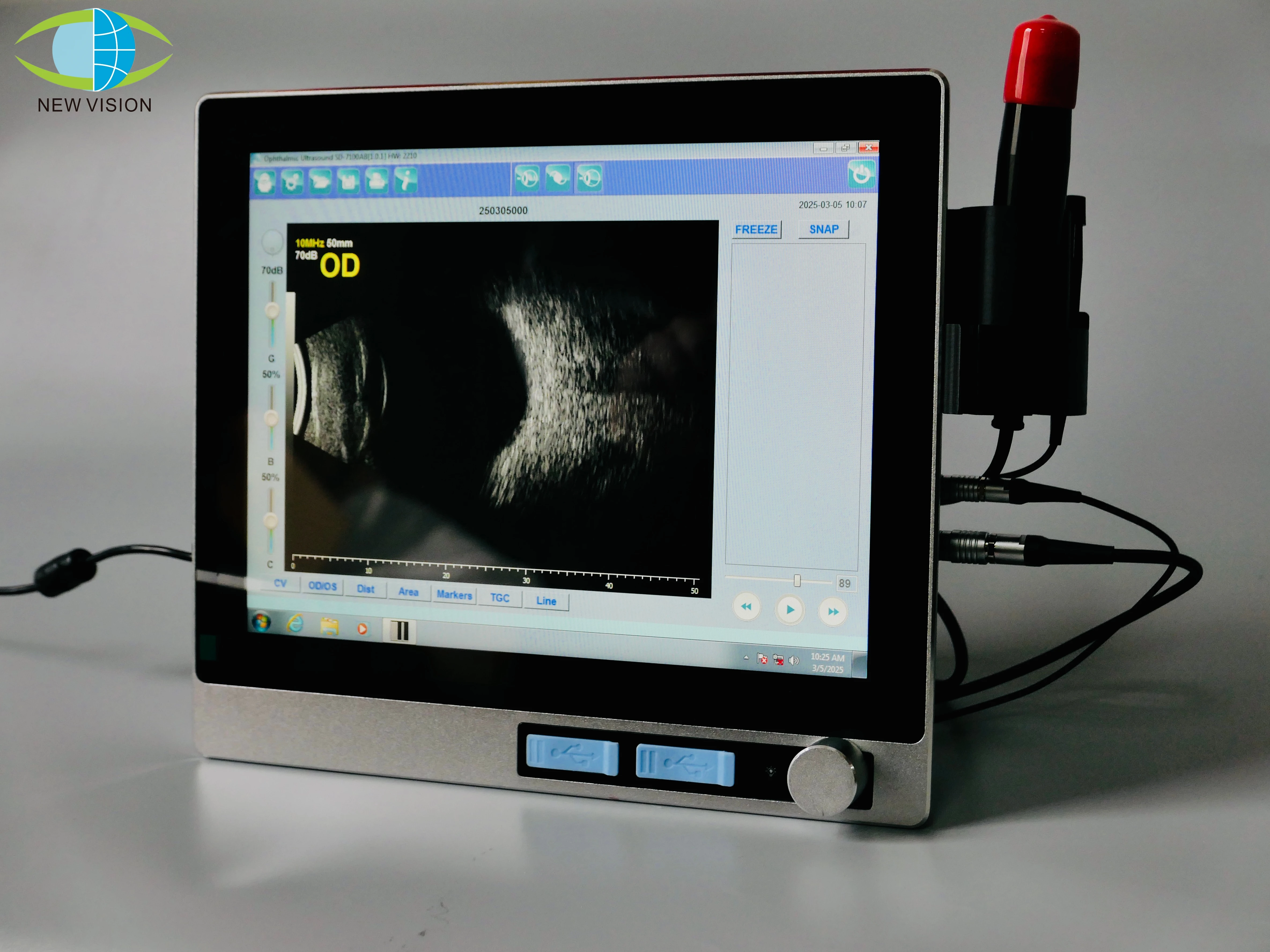 Nv-6000ab офтальмологический ультразвуковой - Фотография_4