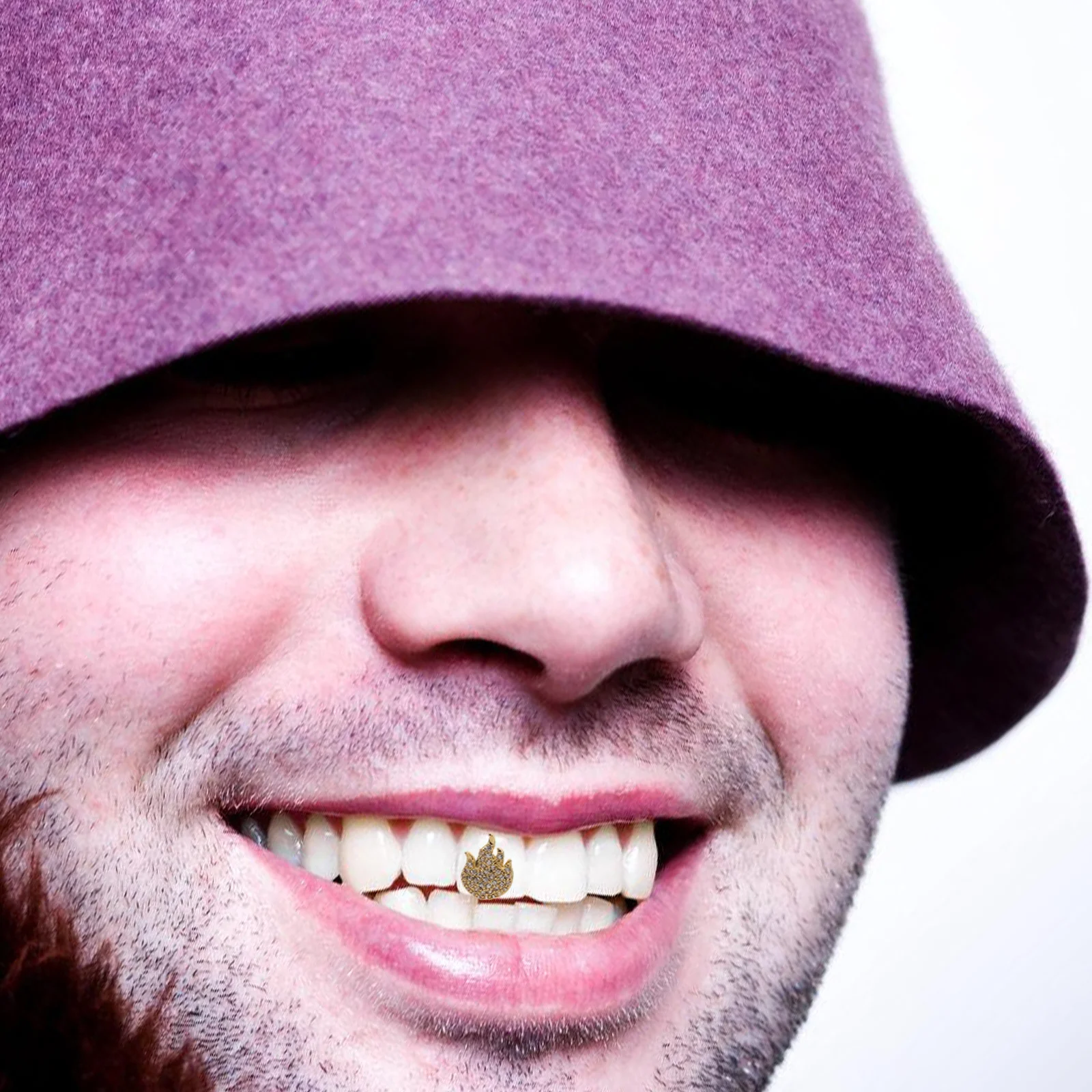 Удобные зубные колпачки в стиле хип-хоп - Фотография_3