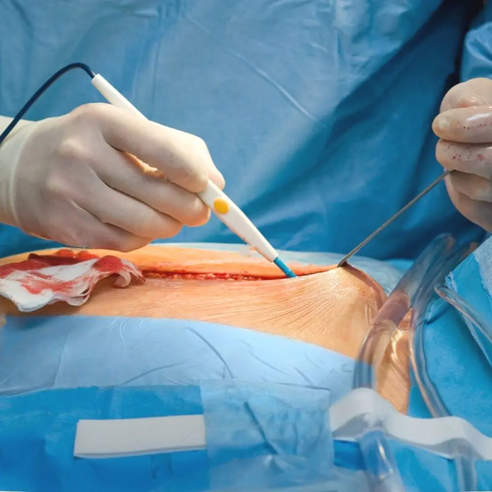 Электрокаутерный электрокоагулятор - Фотография_5