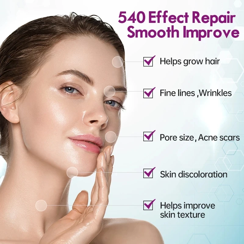 Drs540 derma face roller 540 pin - Фотография_6