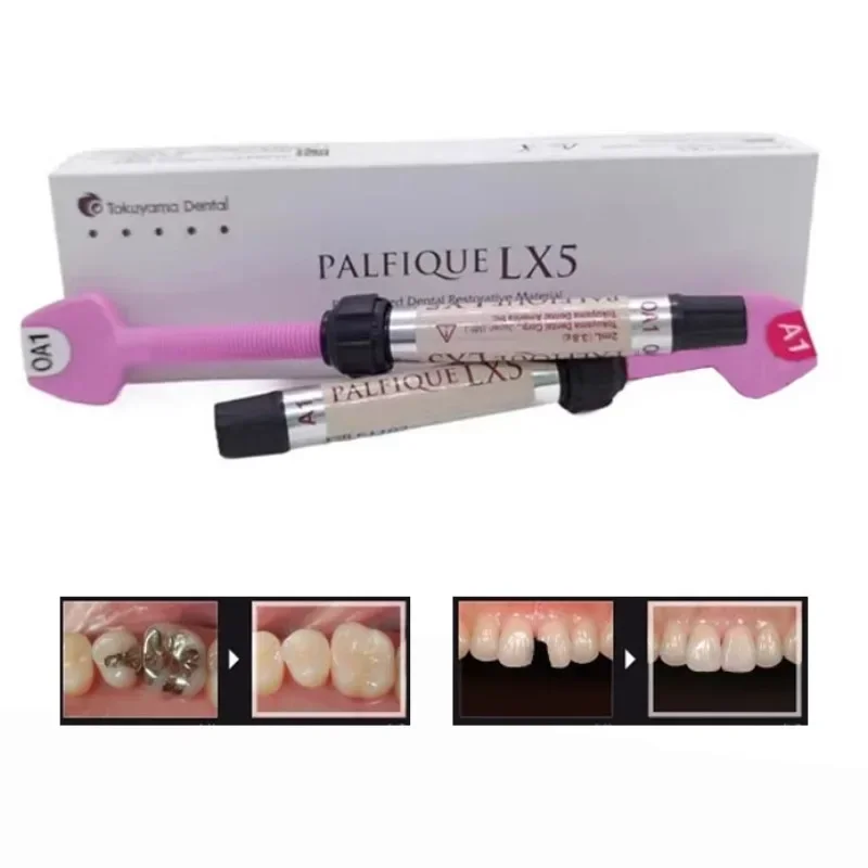 Стоматологический материал lx5 - Фотография_3