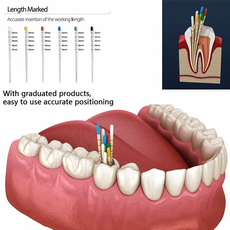 Tjdent dental gutta конус 02 04 06 15 # -40 #   f1 f2 f3 f4 f5 со шкалой - Фотография_2