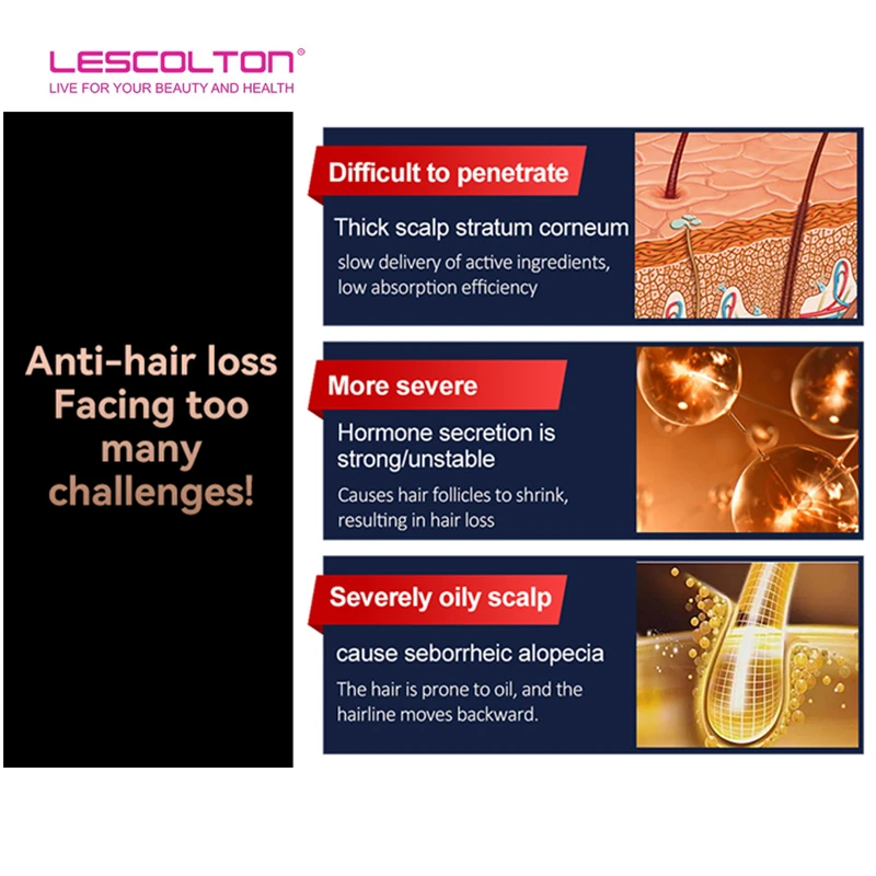 Шлем для роста волос lescolton lllt - Фотография_6