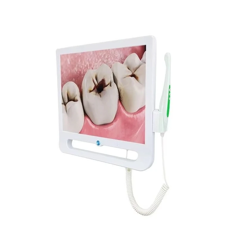 Зубные протезы wi-fi intra oral