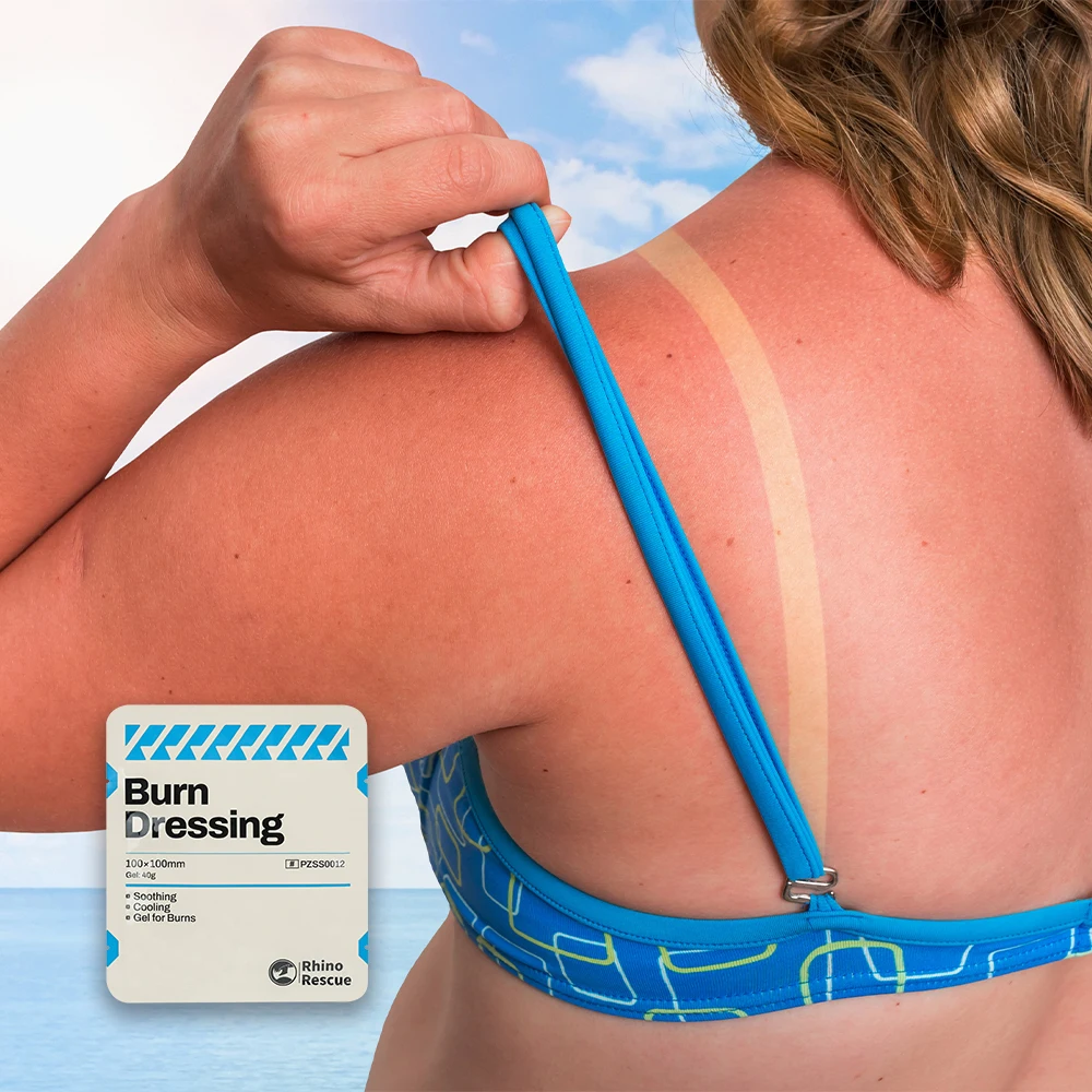 Rhino rescue burn dressing: экстренный гель для ухода за ожогами - Фотография_2