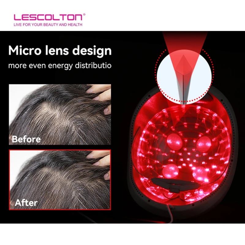 Шлем для роста волос lescolton lllt - Фотография_5