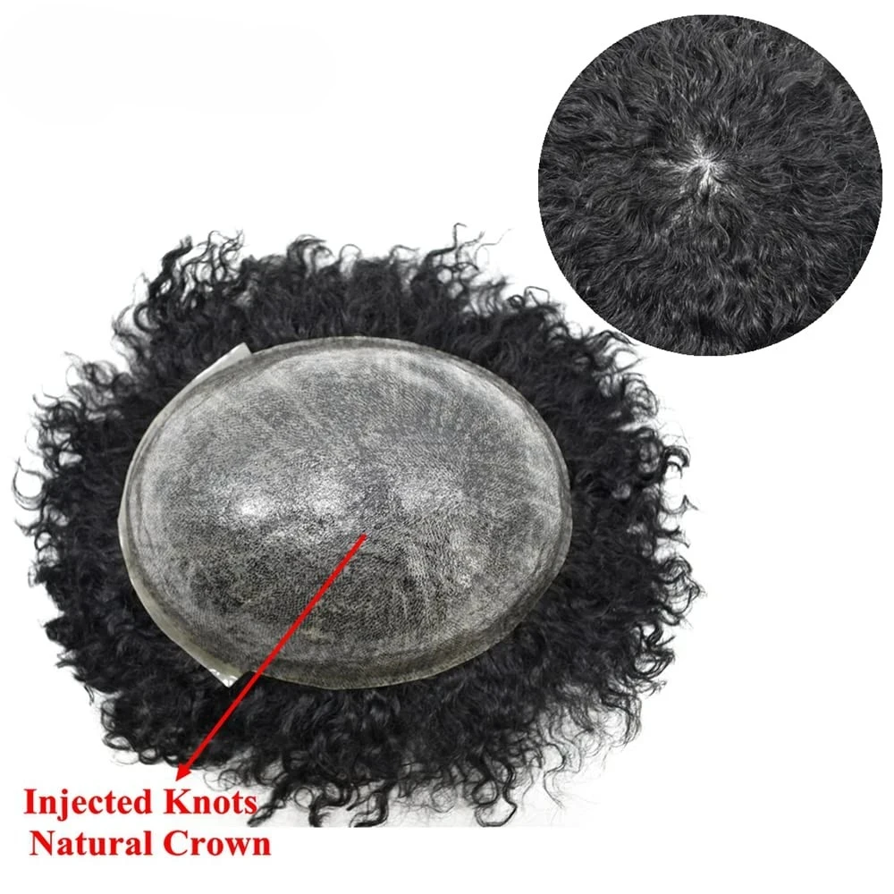 Инъекционная кожа - Фотография_4