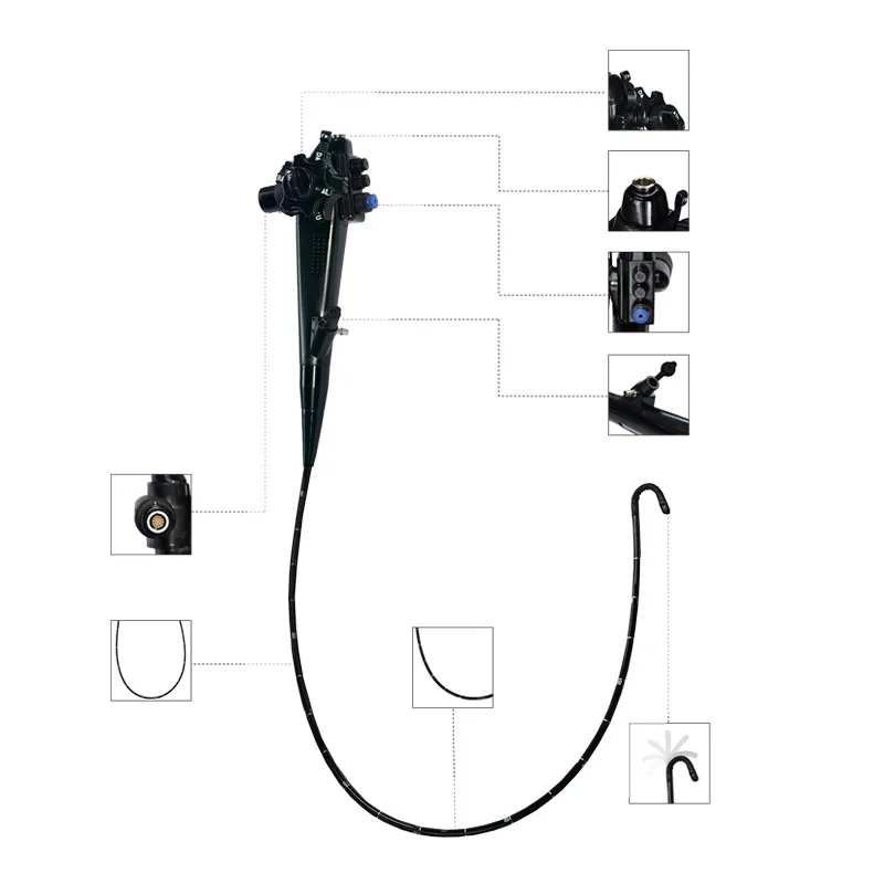 Одобренный ce цифровой гибкий металлический уретероскоп и хронозоскоп - Фотография_5