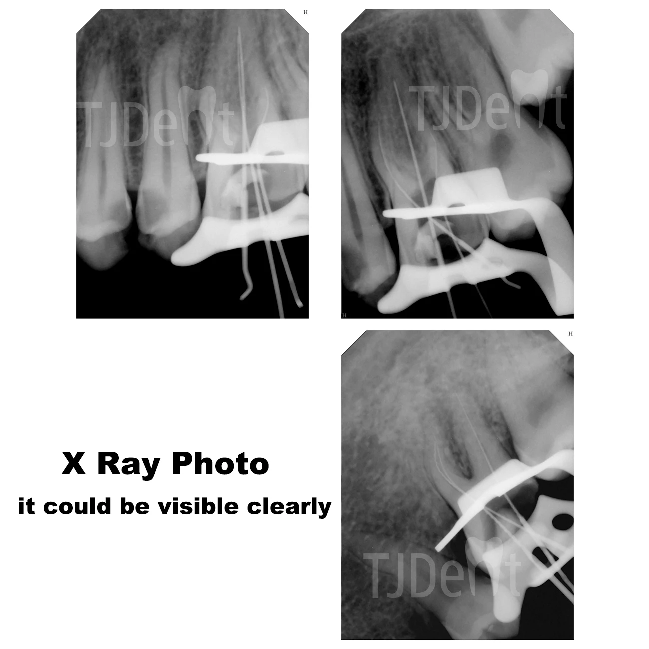 Tjdent dental gutta конус 02 04 06 15 # -40 #   f1 f2 f3 f4 f5 со шкалой - Фотография_3