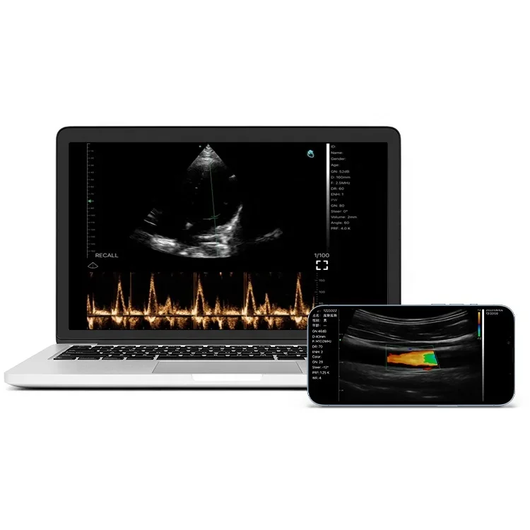 Ультразвуковой сканер для смартфона viatom c10 - Фотография_5