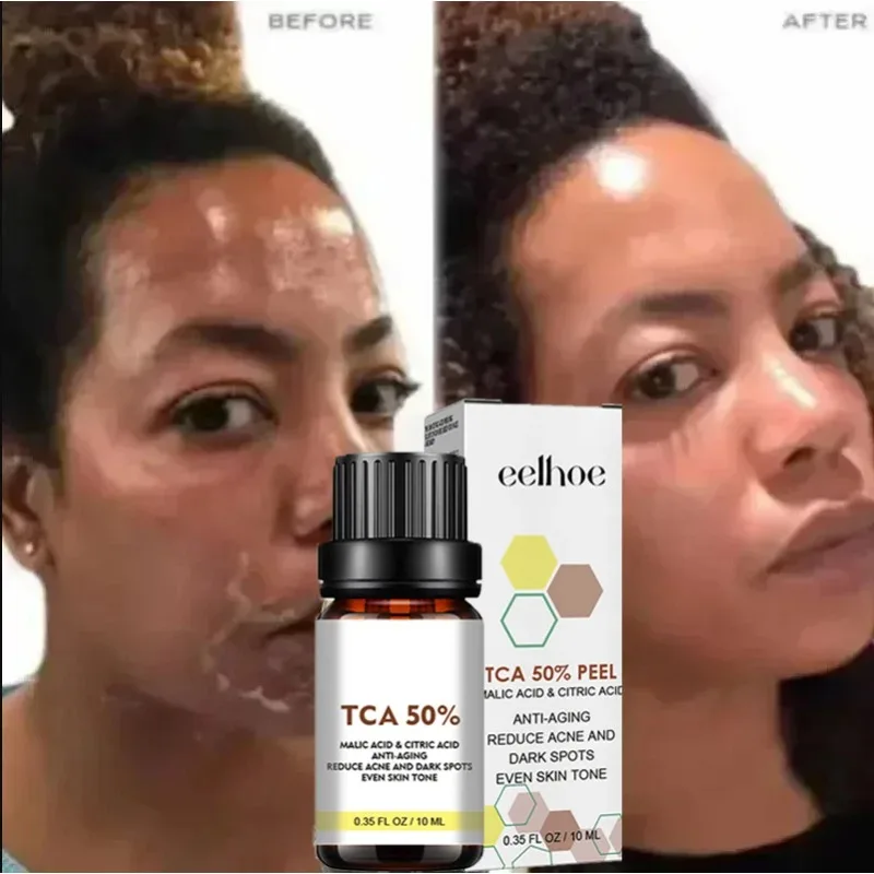 Пилинг для лица с салициловой кислотой - Фотография_3