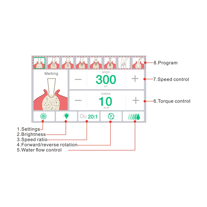 Система двигателя vvdental implant - Фотография_3