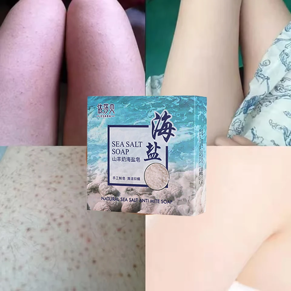 Морская соль, мыло для удаления прыщей на теле - Фотография_3