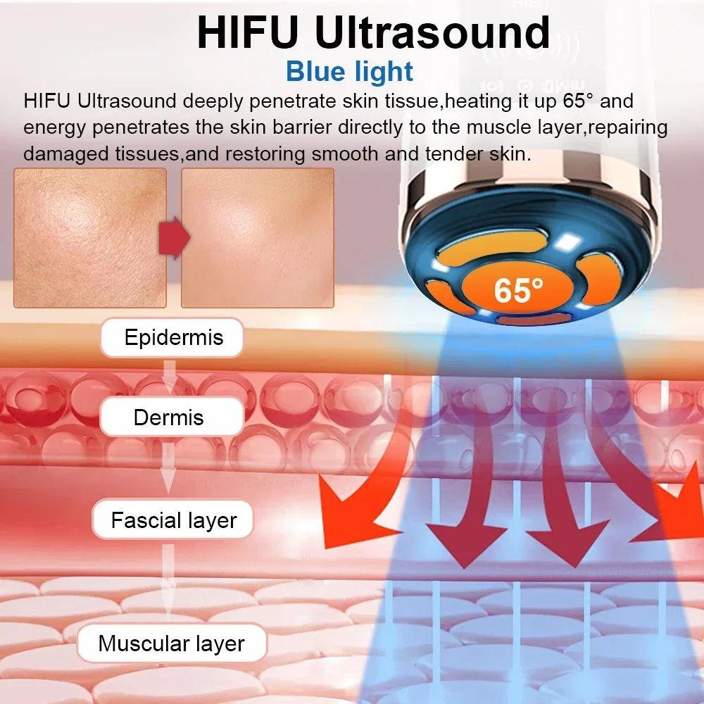 Hifu машина для лифтинга лица rf - Фотография_3
