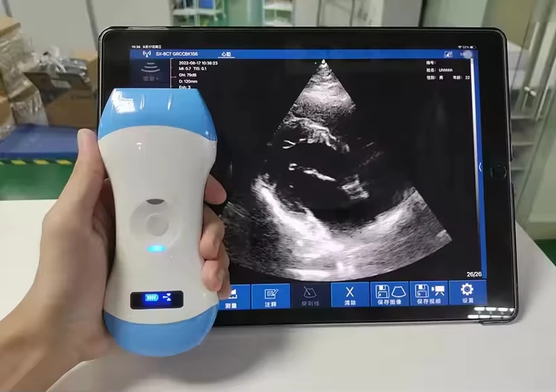 In-5cpl высокая визуализация ультразвуковой - Фотография_5